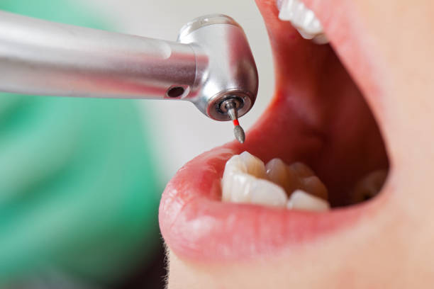 Best Emergency Tooth Extraction  in Waldron, AR